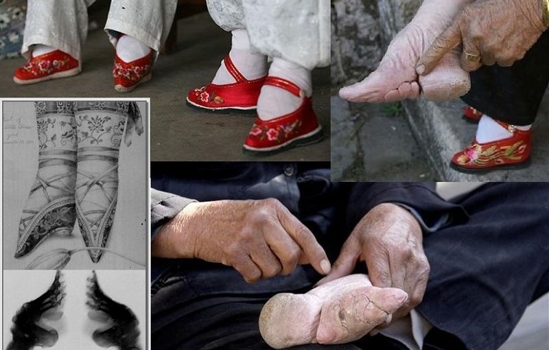 Бинтование ног китайским девушкам