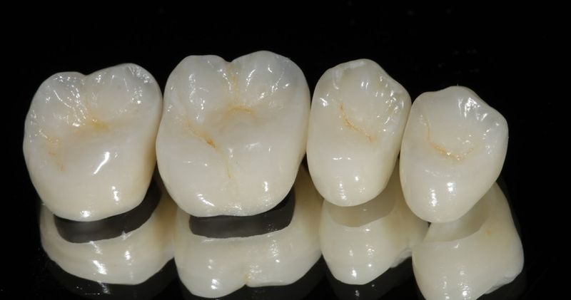 Титанокерамика