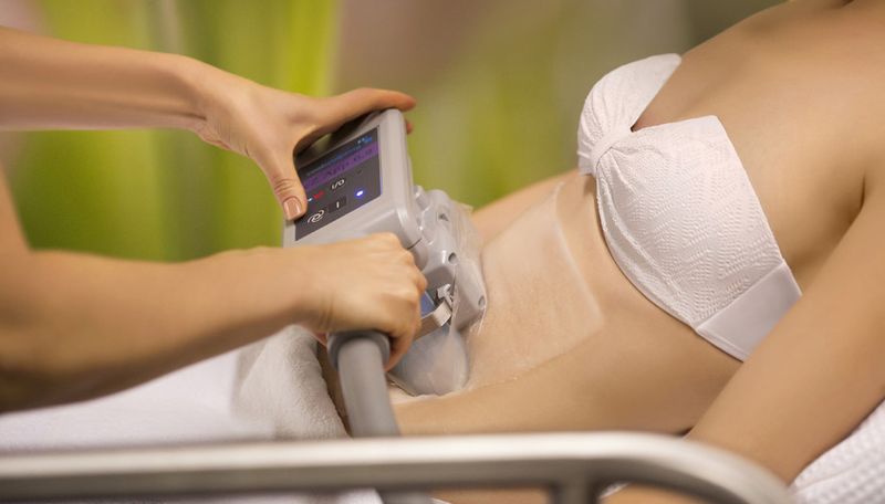 Криолиполиз