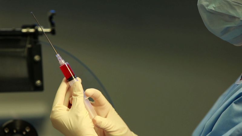 Омоложение введением фибробластов и стволовых клеток