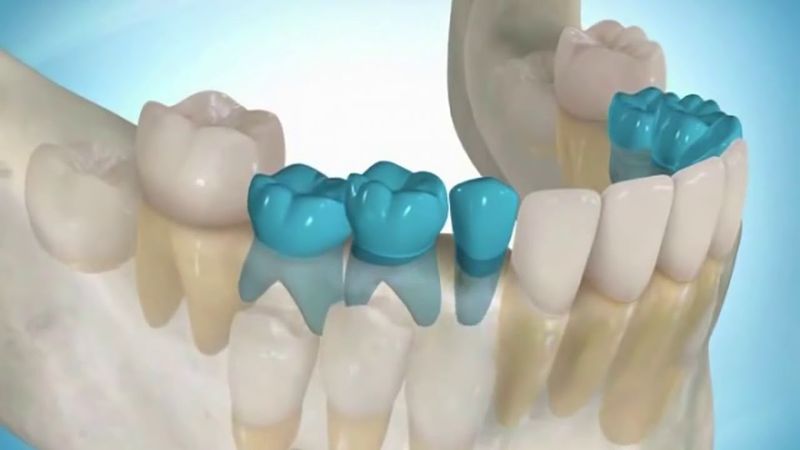 Технология выращивания зубов