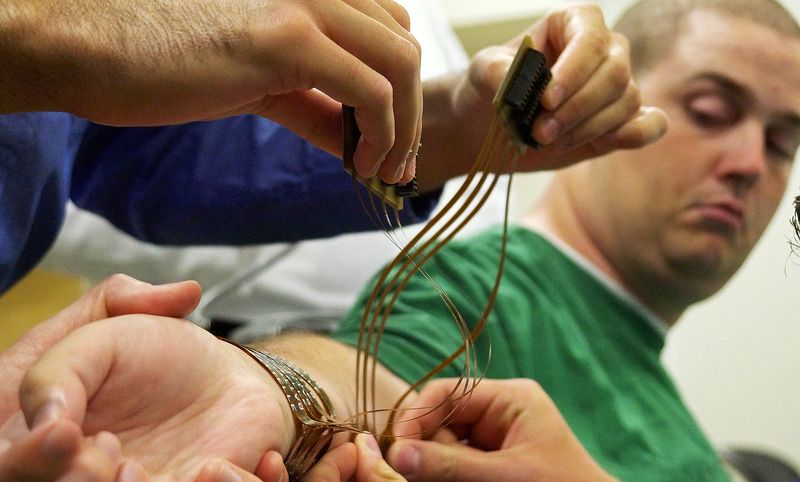 Имплантат от паралича