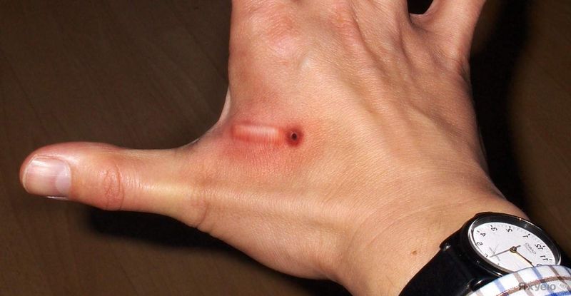 Чипы в теле