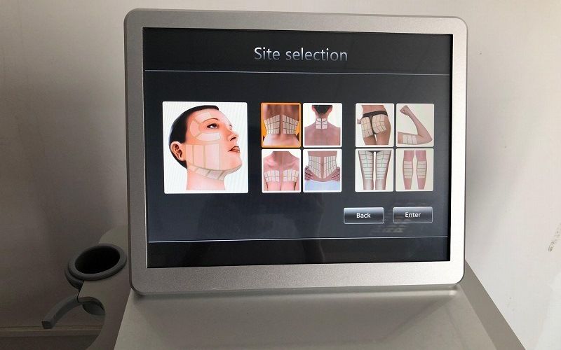 Ультразвуковой лифтинг HIFU