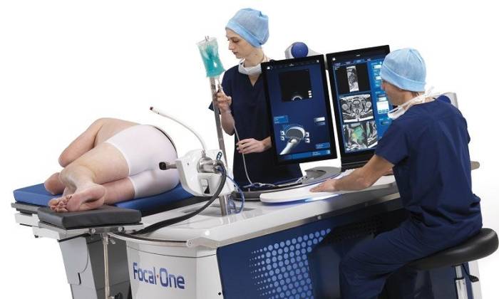 Противопоказания для HIFU