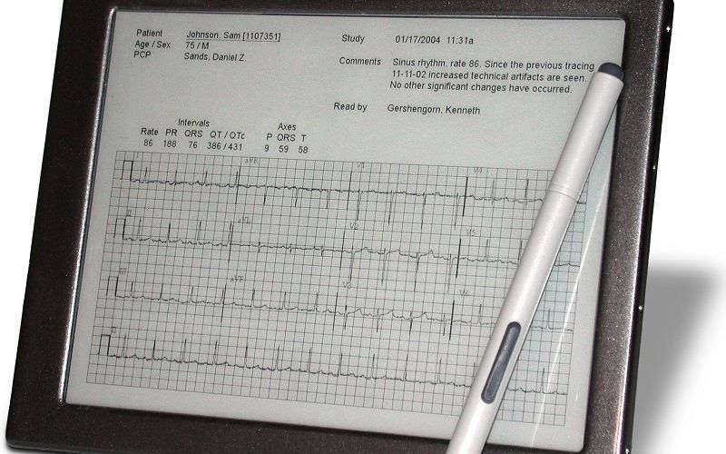 Создание технологии дисплея E-Ink