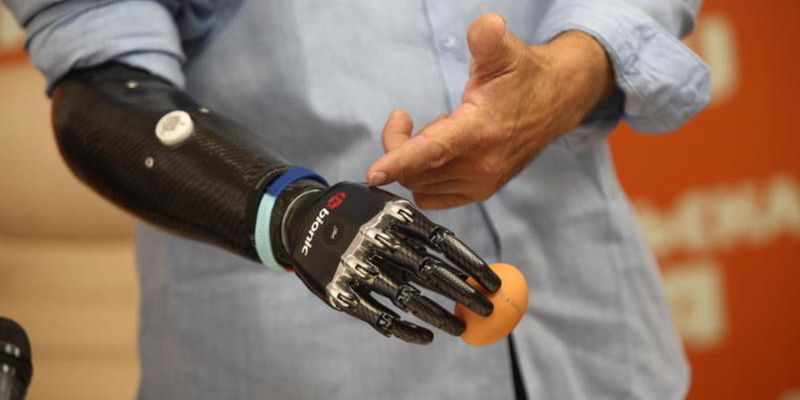 Бионический протез