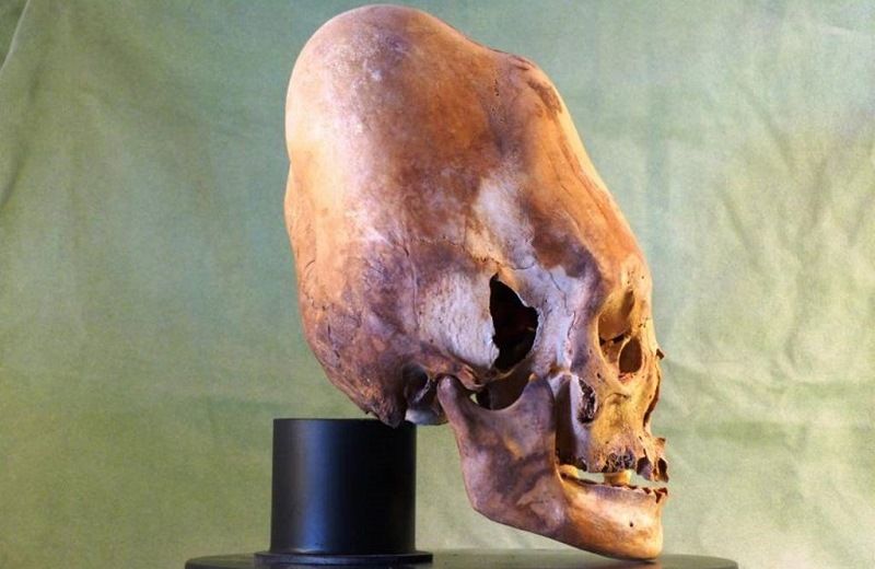 Удлиненные черепа, найденные на Антарктиде