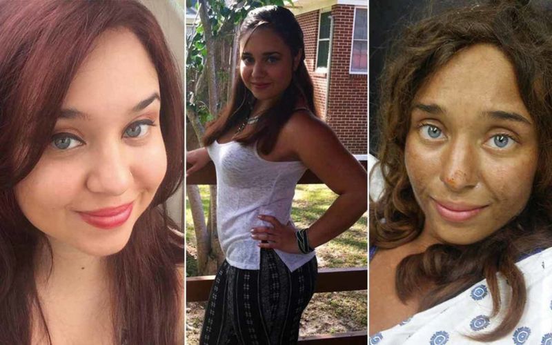 Лиза Терис до и после пропажи