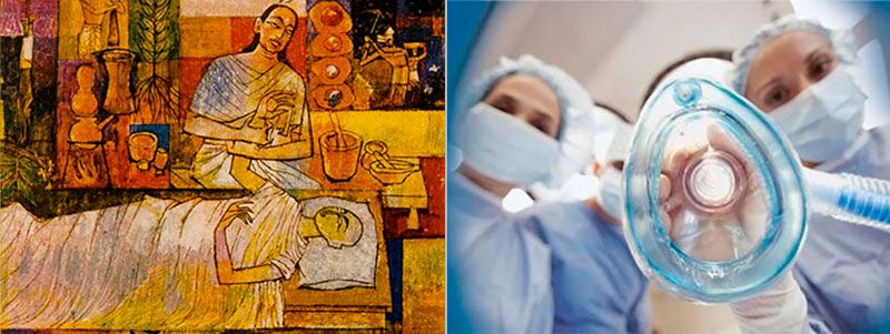 Возникновение и развитие анестезии