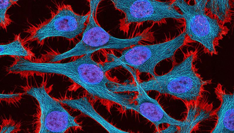 Клетки ХеЛа